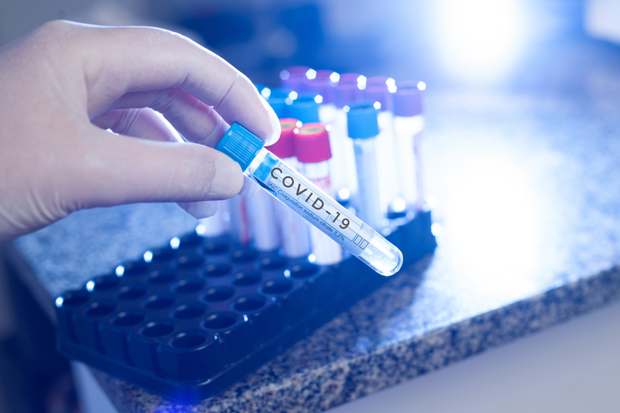 Rapid COVID Testing vs Molecular COVID Testing